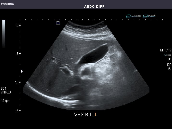 Why Am I Not Allowed To Record My Ultrasound?